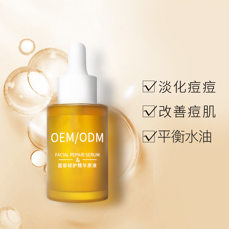 琼滋女王_祛痘精华原液OEM