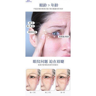 琼滋女王_美容院玻尿酸微针眼贴